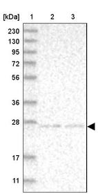 Lane 1: Marker [kDa] 230, 130, 95, 72, 56, 36, 28, 17, 11_br/_Lane 2: Human cell line RT-4_br/_Lane 3: Human cell line U-251MG sp