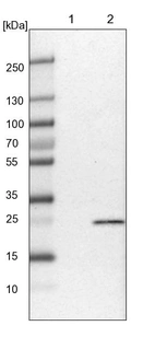 Lane 1: NIH-3T3 cell lysate (Mouse embryonic fibroblast cells)_br/_Lane 2: NBT-II cell lysate (Rat Wistar bladder tumour cells)