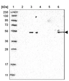 Lane 1: Marker [kDa] 230, 130, 95, 72, 56, 36, 28, 17, 11_br/_Lane 2: Human cell line RT-4_br/_Lane 3: Human cell line U-251MG sp_br/_Lane 4: Human plasma (IgG/HSA depleted)_br/_Lane 5: Human liver tissue_br/_Lane 6: Human tonsil tissue