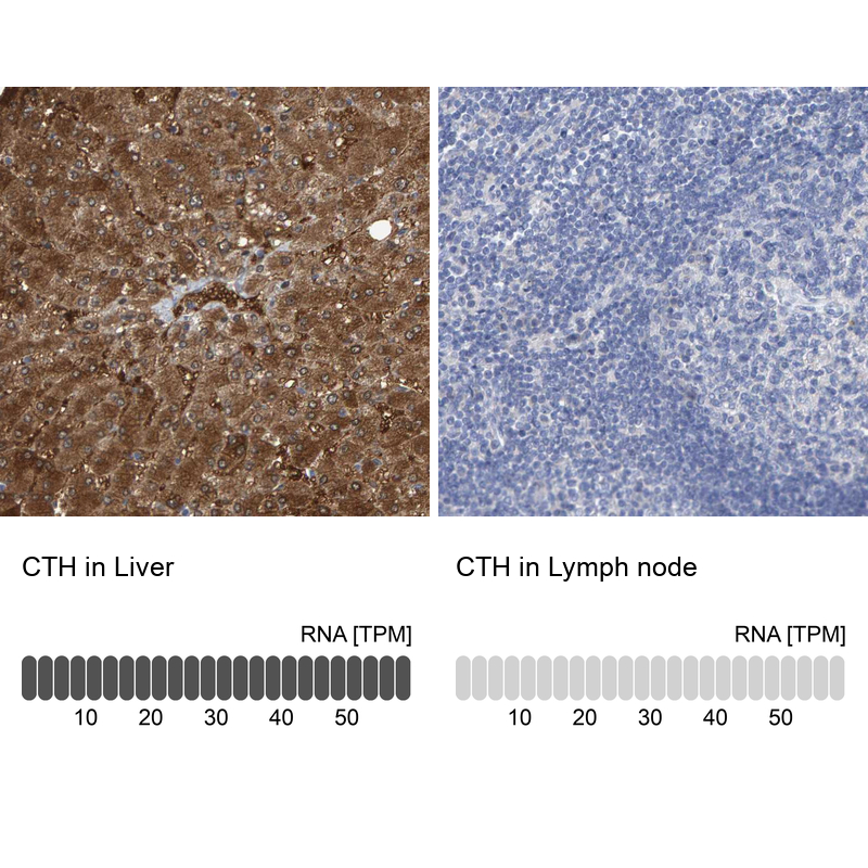 Anti-CTH Antibody