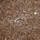 Immunohistochemical staining of human liver shows high expression.
