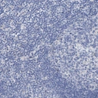 Immunohistochemical staining of human lymph node shows low expression as expected.