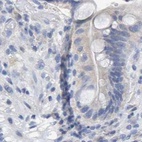 Immunohistochemical staining of human colon using Anti-CTH antibody HPA021591.