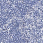 Anti-CTH Antibody