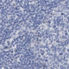Immunohistochemical staining of human lymph node using Anti-CTH antibody HPA021591.