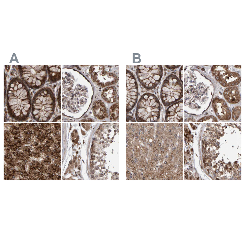 Anti-PECR Antibody
