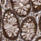 Immunohistochemical staining of human colon using Anti-PECR antibody HPA021593.