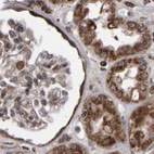 Immunohistochemical staining of human kidney using Anti-PECR antibody HPA021593.