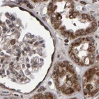Immunohistochemical staining of human kidney using Anti-PECR antibody HPA021593.