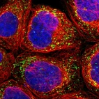 Immunofluorescent staining of human cell line A-431 shows localization to peroxisomes.