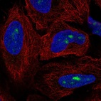Anti-ZNF286A Antibody