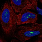 Anti-ZNF286A Antibody