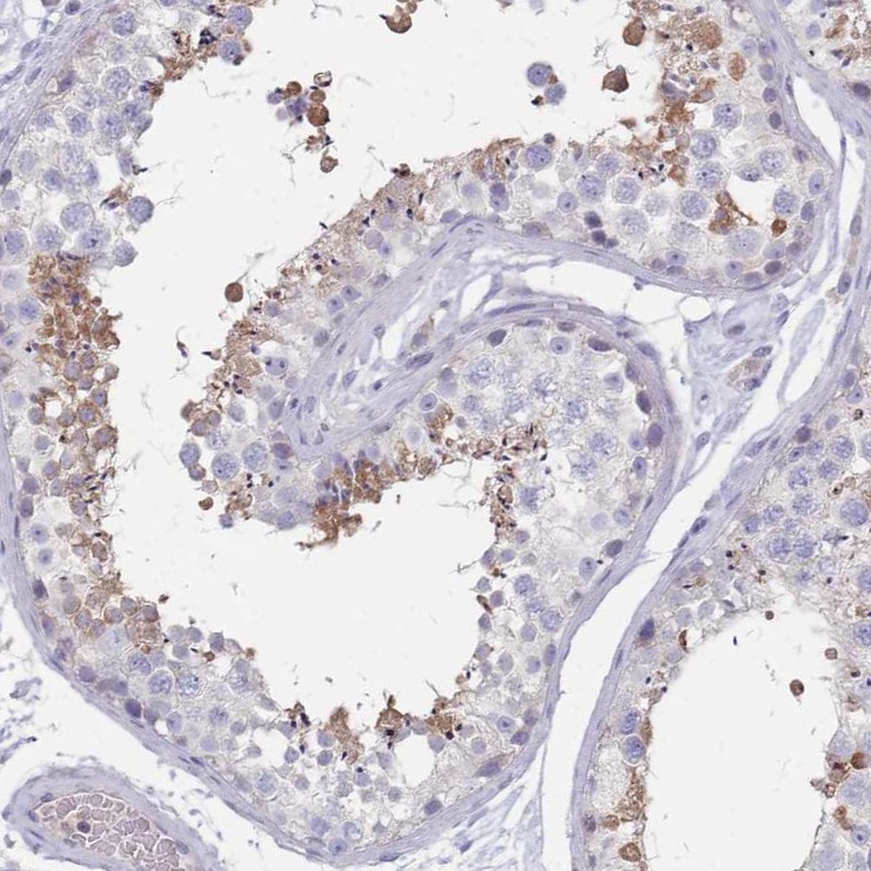 Anti-RAB11FIP4 Antibody