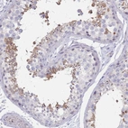 Anti-RAB11FIP4 Antibody