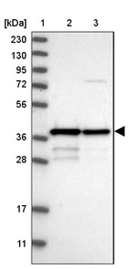 Lane 1: Marker [kDa] 230, 130, 95, 72, 56, 36, 28, 17, 11_br/_Lane 2: Human cell line RT-4_br/_Lane 3: Human cell line U-251MG sp