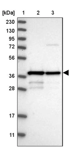 Lane 1: Marker [kDa] 230, 130, 95, 72, 56, 36, 28, 17, 11_br/_Lane 2: Human cell line RT-4_br/_Lane 3: Human cell line U-251MG sp