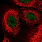 Immunofluorescent staining of human cell line A-431 shows localization to nucleoplasm.