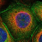 Immunofluorescent staining of human cell line A-431 shows localization to cytosol & cell junctions.
