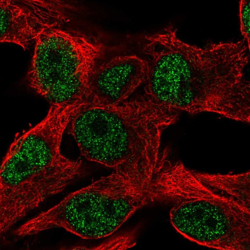 Anti-PPP1R35 Antibody