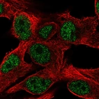 Anti-PPP1R35 Antibody