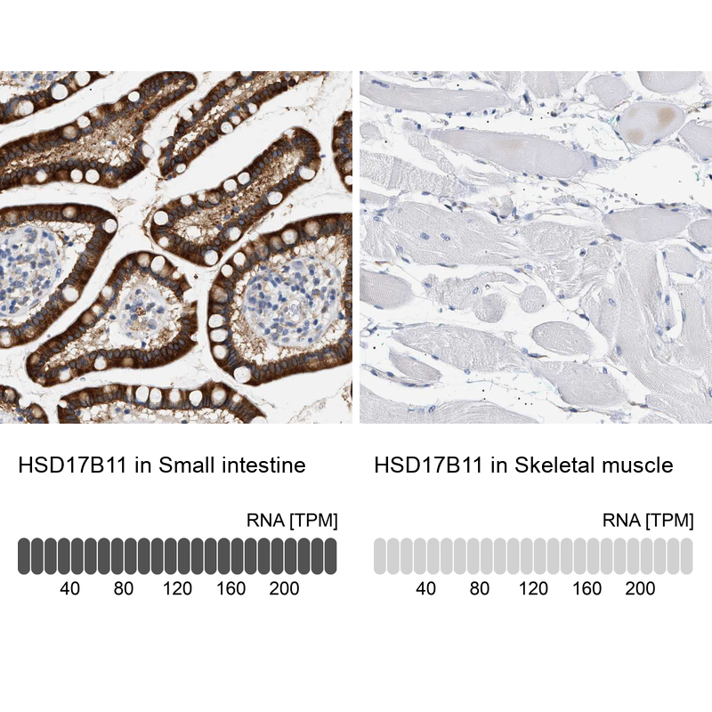 Anti-HSD17B11 Antibody