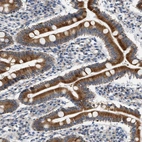 Immunohistochemical staining of human duodenum shows moderate to strong cytoplasmic positivity in glandular cells.