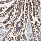 Immunohistochemical staining of human colon shows moderate to strong cytoplasmic positivity in glandular cells.