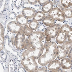 Immunohistochemical staining of human kidney shows weak to moderate cytoplasmic positivity in cells in tubules.