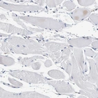 Immunohistochemical staining of human skeletal muscle shows no positivity in myocytes as expected.