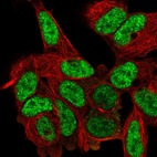 Immunofluorescent staining of human cell line SH-SY5Y shows localization to nucleoplasm.
