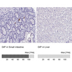 Anti-GIP Antibody