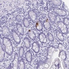 Immunohistochemical staining of human small intestine shows high expression.