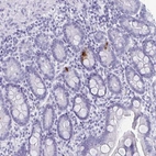 Immunohistochemical staining of human small intestine shows high expression.