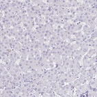 Anti-GIP Antibody