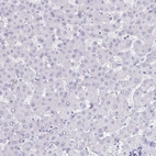 Immunohistochemical staining of human liver shows low expression as expected.