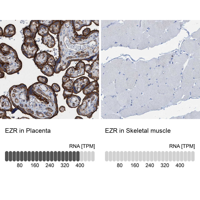 Anti-EZR Antibody