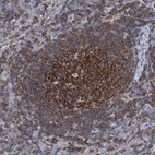 Immunohistochemical staining of human lymph node shows strong membranous positivity in germinal center cells.