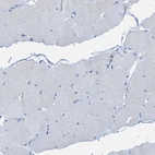 Immunohistochemical staining of human skeletal muscle shows no positivity in myocytes as expected.