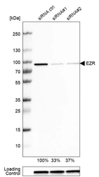 Western blot analysis in U-251MG cells transfected with control siRNA, target specific siRNA probe #1 and #2, using Anti-EZR antibody. Remaining relative intensity is presented. Loading control: Anti-GAPDH.