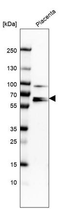 Western blot analysis in human placenta tissue.
