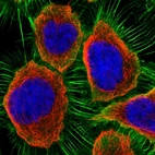 Immunofluorescent staining of human cell line A-431 shows localization to plasma membrane.