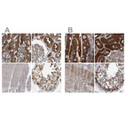 Immunohistochemical staining of human duodenum, kidney, skeletal muscle and testis using Anti-GLOD4 antibody HPA021623 (A) shows similar protein distribution across tissues to independent antibody HPA023246 (B).