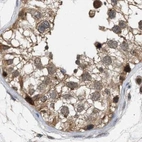 Immunohistochemical staining of human testis using Anti-GLOD4 antibody HPA021623.