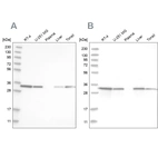 Western blot analysis using Anti-GLOD4 antibody HPA021623 (A) shows similar pattern to independent antibody HPA023246 (B).