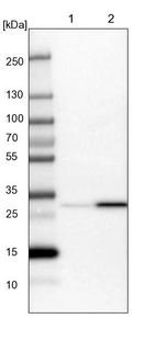 Lane 1: NIH-3T3 cell lysate (Mouse embryonic fibroblast cells)_br/_Lane 2: NBT-II cell lysate (Rat Wistar bladder tumour cells)