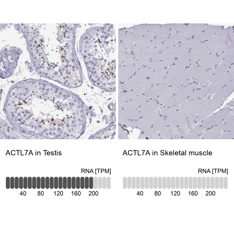Anti-ACTL7A Antibody