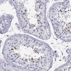 Immunohistochemical staining of human testis shows strong positivity in acrosomes in cells in seminiferous ducts.