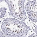 Immunohistochemical staining of human testis shows strong positivity in acrosomes in cells in seminiferous ducts.