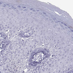 Immunohistochemical staining of human skin shows no positivity in squamous epithelial cells as expected.