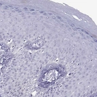 Immunohistochemical staining of human skin shows no positivity in squamous epithelial cells as expected.